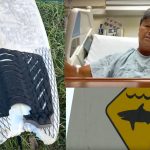 ハワイ・オアフ島サウスショアのケワロ・ベイスンでサーファーがシャークアタックに遭い右足を失う
